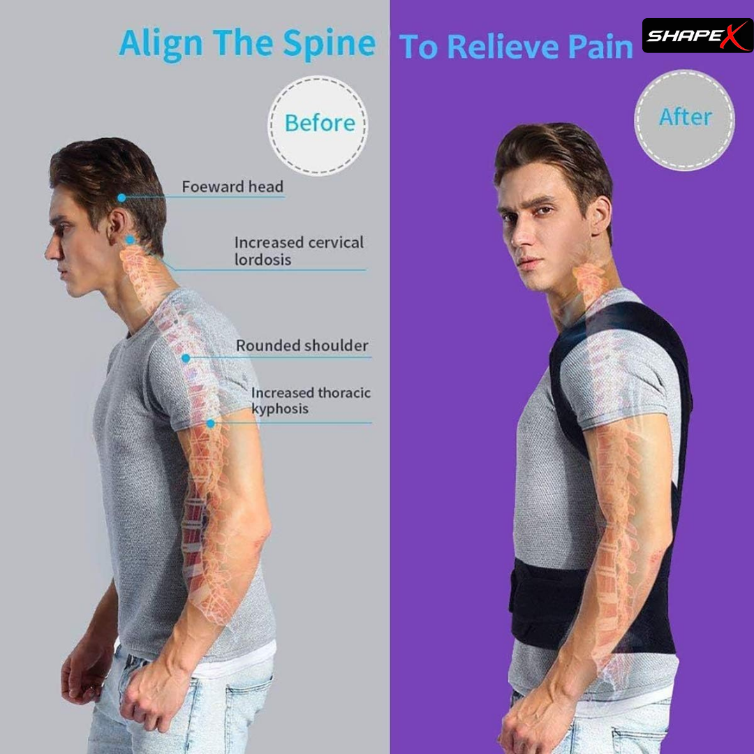 SHAPE X Posture Corrector – Relieve Back & Neck Pain, Align Spine, Improve Posture in 3 Weeks